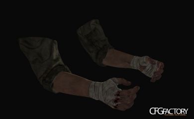 Wounded Hands